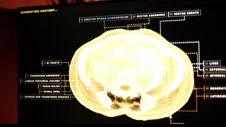 Full-body ultrasound scan visualization showing anatomical segmentation