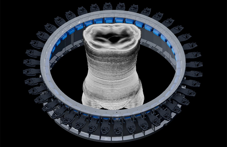 Illustration of Midjourney's Ultrasonic CT prototype showing Butterfly Network ultrasound chips arranged in a ring