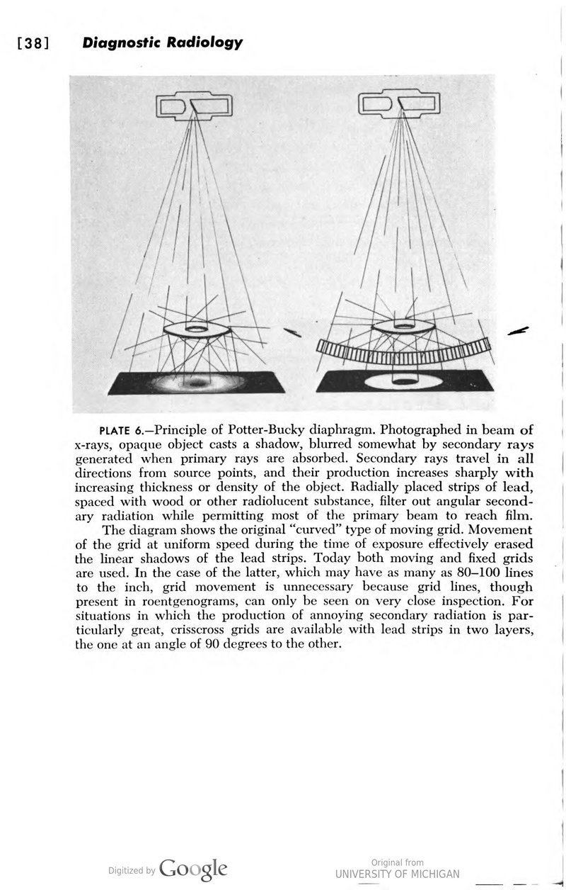 Principle of Potter-Bucky diaphragm diagram showing how a curved moving grid filters out secondary radiation while permitting the primary beam to reach the film