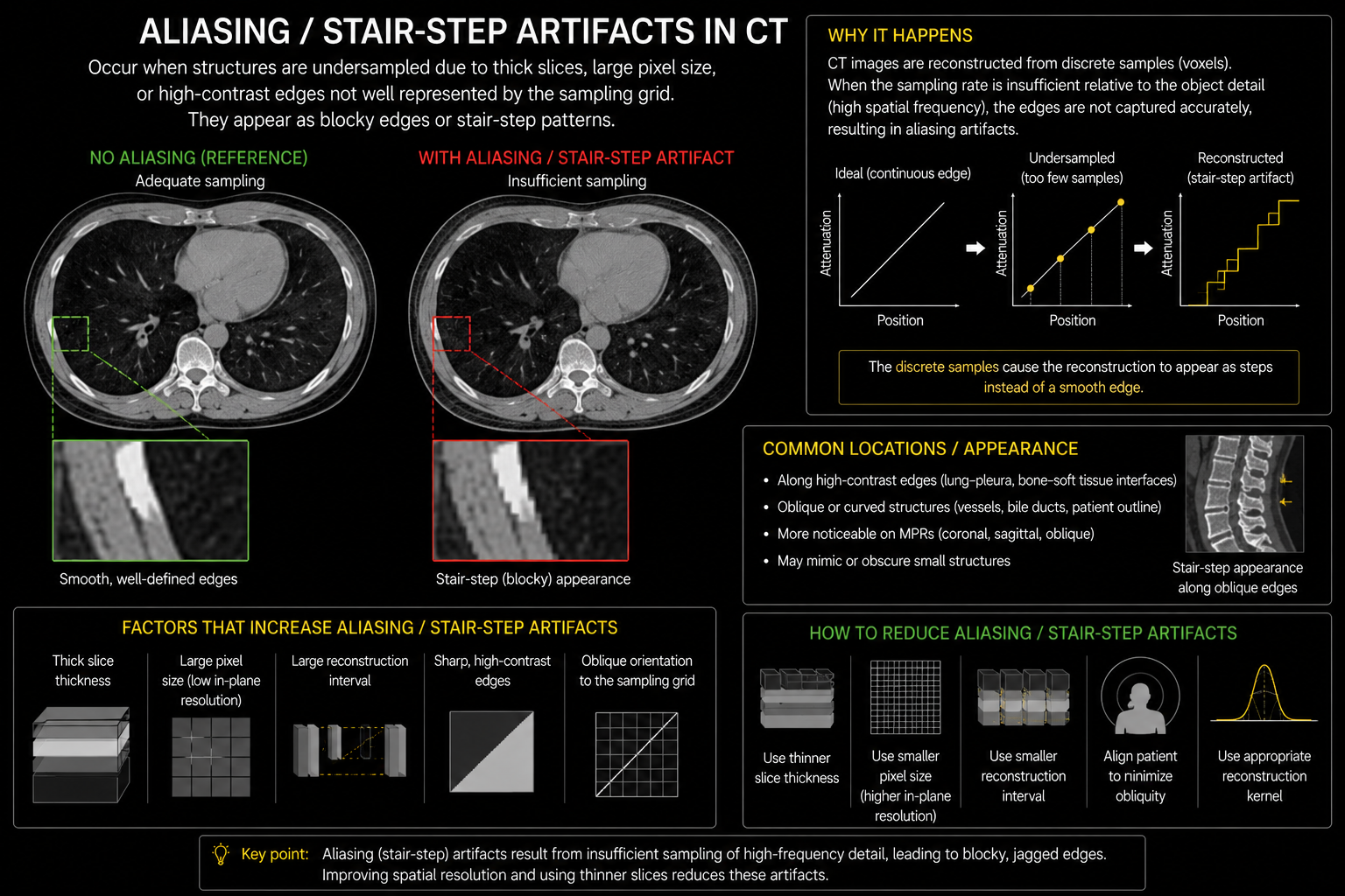 Aliasing and stair-step CT artifact infographic