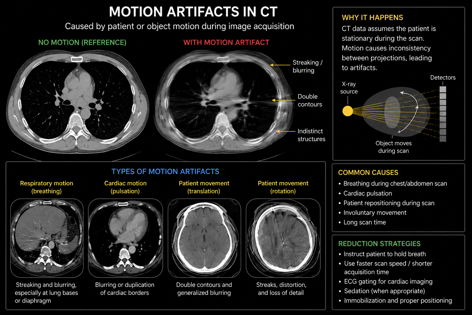 Motion CT artifact infographic