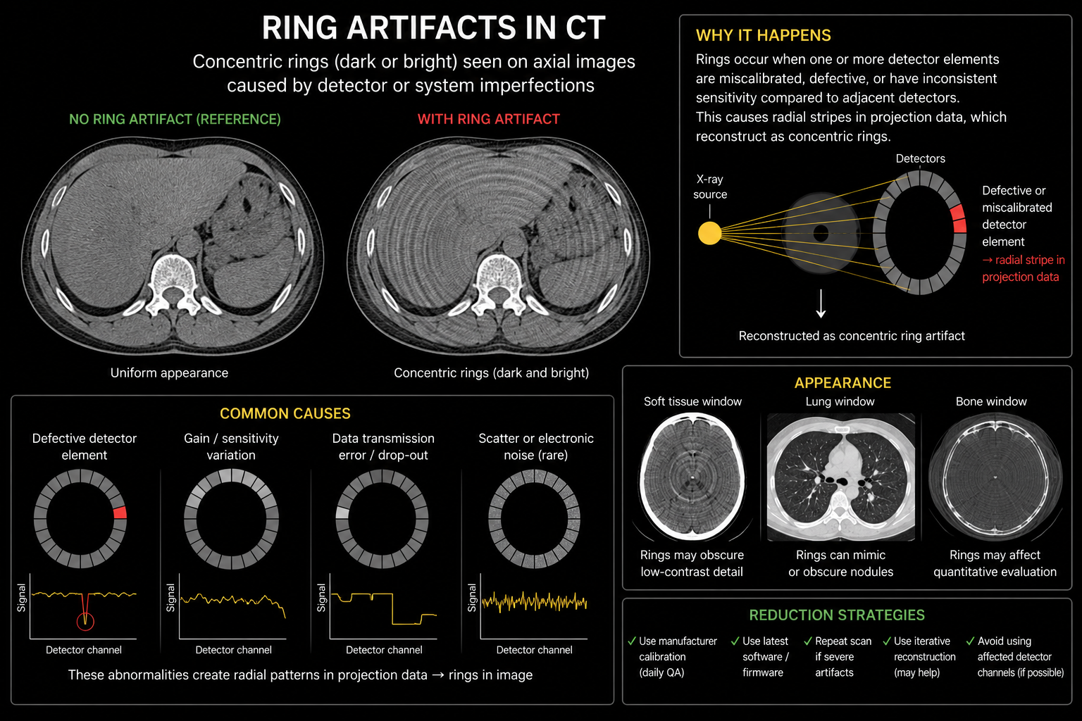 Ring CT artifact infographic