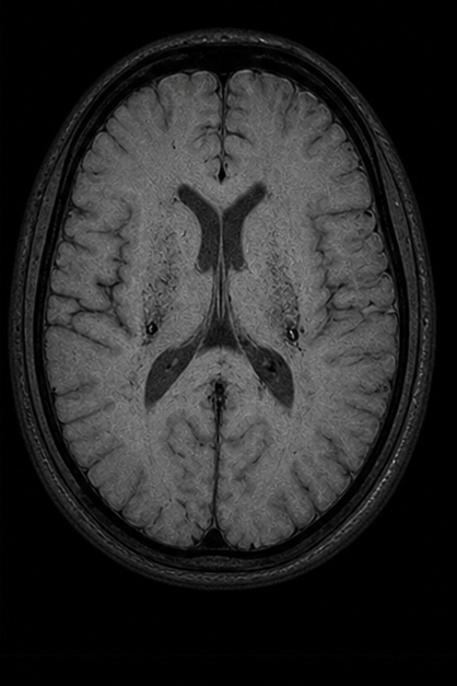 Generated axial gradient echo brain MRI scan with susceptibility-sensitive contrast