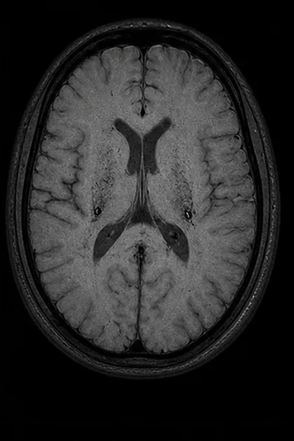 Generated axial gradient echo brain MRI scan with susceptibility-sensitive contrast