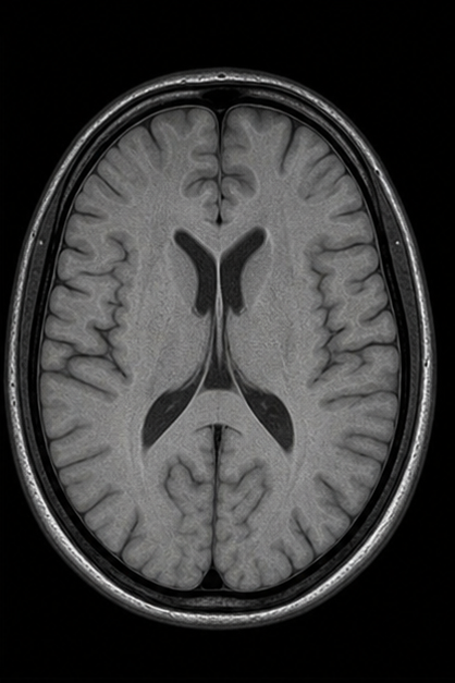 Generated axial proton-density brain MRI scan with balanced tissue contrast