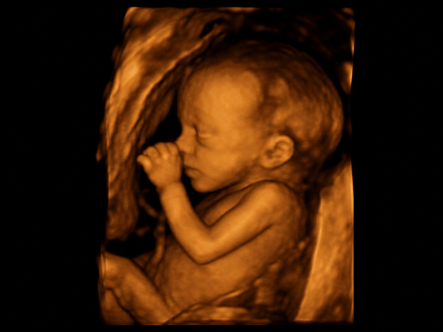 3D/4D fetal ultrasound image of a baby in profile.